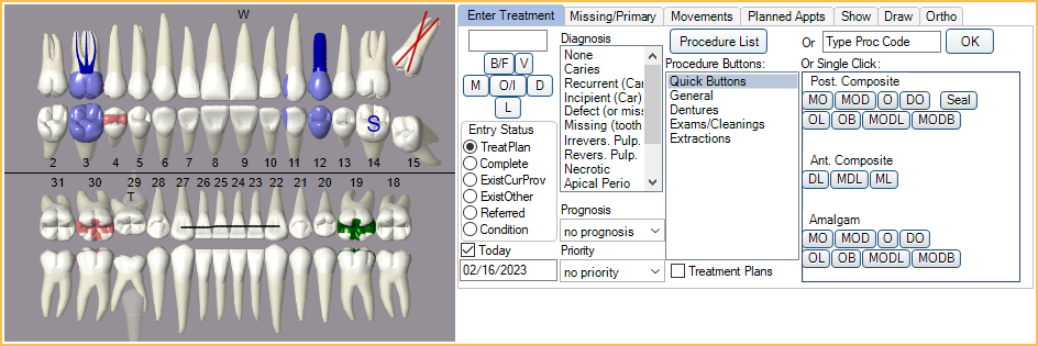 open dental software tutorial