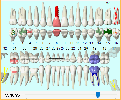 teeth numbers and surfaces