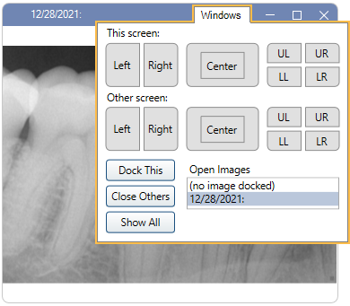 dental radiology fmx